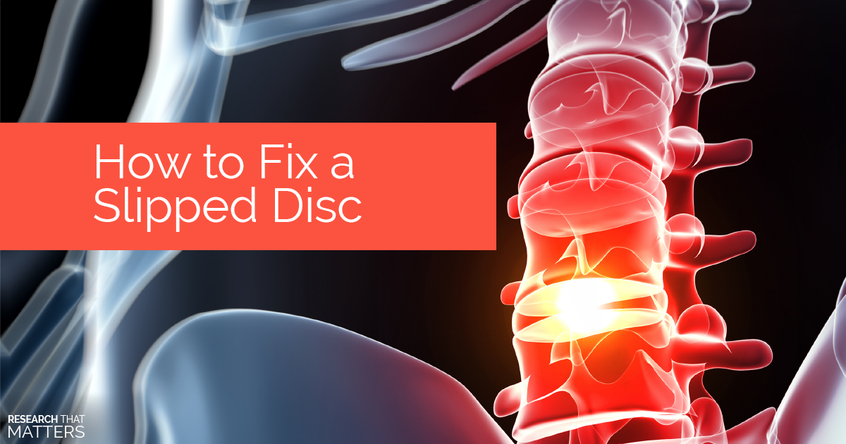 herniated-disc-new-study-shows-conservative-care-first-sycamore