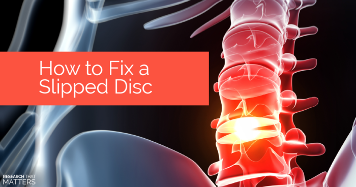 How to Fix a Slipped Disc – New Smyrna Beach Spine & Injury Center ...